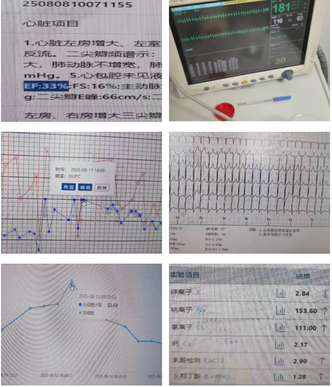七旬脑梗+多器官衰竭,桂林医科大学一附院「中西合璧」72 小时挽救生命!