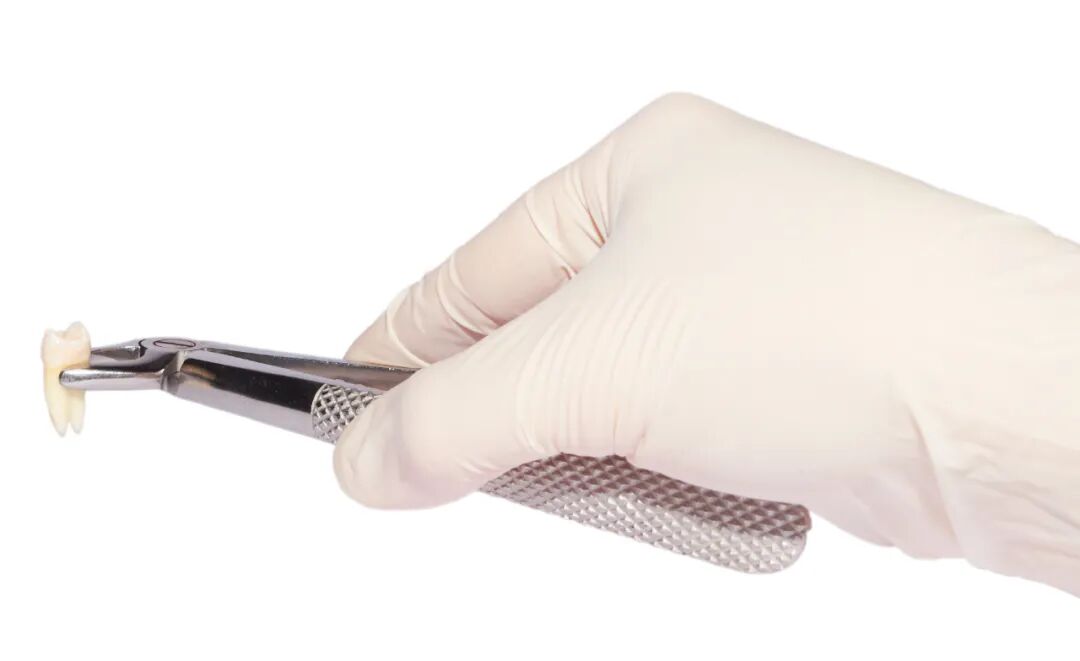 拔牙后为什么不建议你吐口水?