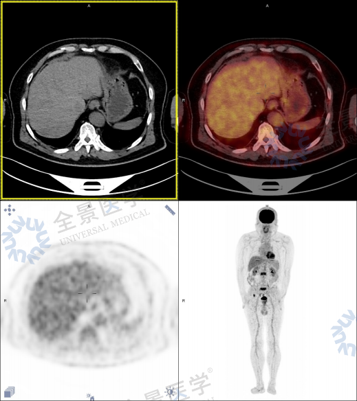 两年拖延,一次检查揭开隐匿的危机