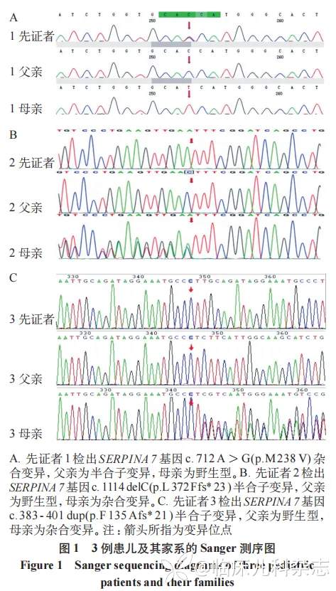 甲状腺结合球蛋白缺乏症 3 个家系报告
