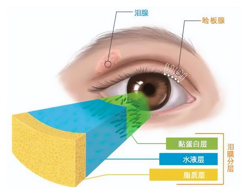 「泪流不止」竟因干眼？精准诊疗破解顽固眼疾——揭开干眼伪装