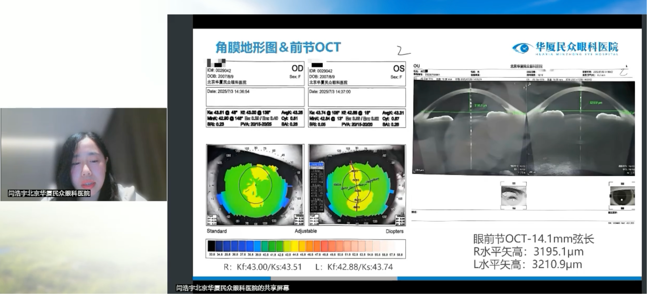 北京华厦民众眼科医院闫浩宇医师:以巩膜镜精准定位,重塑干眼与角膜神经痛患者视觉舒适与健康