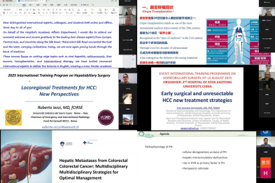 2025 年西交·通全球暑期学校 「肝脏新丝路：『一带一路』肝病与移植研究的跨境交流」课程圆满收官