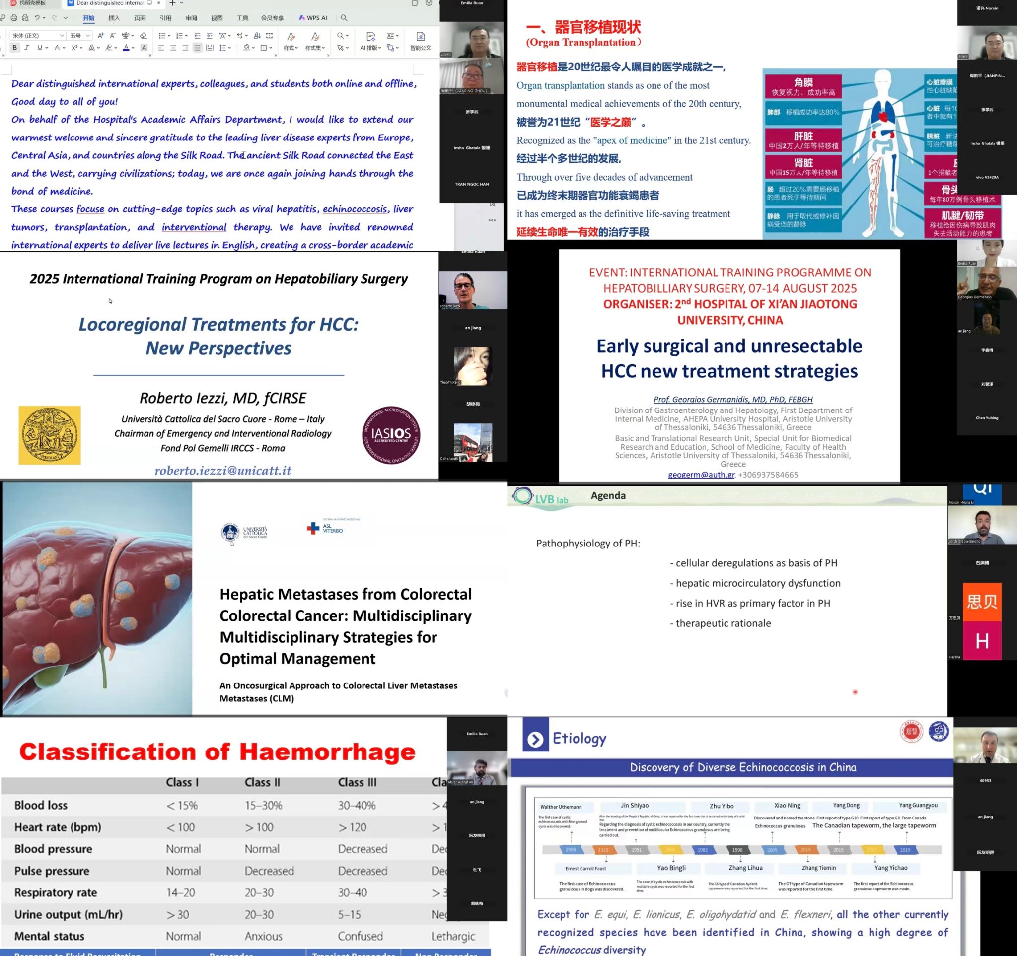 2025 年西交·通全球暑期学校 「肝脏新丝路:『一带一路』肝病与移植研究的跨境交流」课程圆满收官