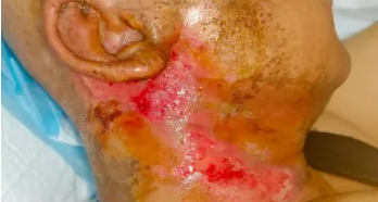 倾听皮肤的故事,重塑生命的温度