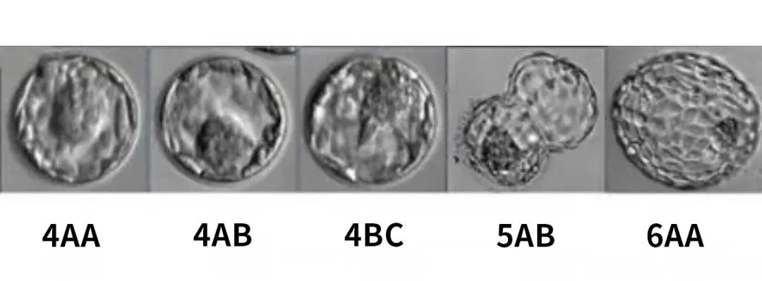 江湾试管婴儿百科：胚胎等级怎么看？