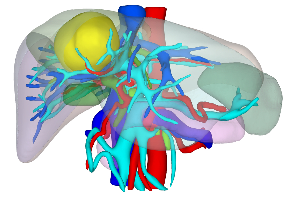 桂医二附院成功完成首例经腹腔镜荧光引导下精准切除肝脏「中央区」肿瘤