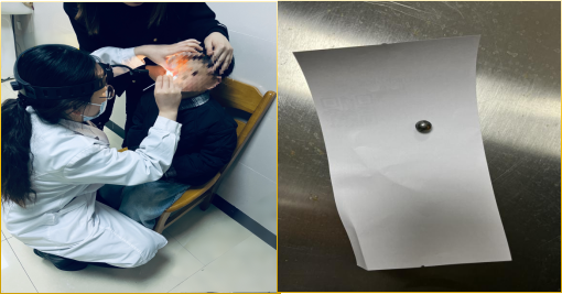 「妈妈，我鼻子里有弹珠！」好奇宝宝之遇到鼻腔异物怎么办？千万别用手抠！