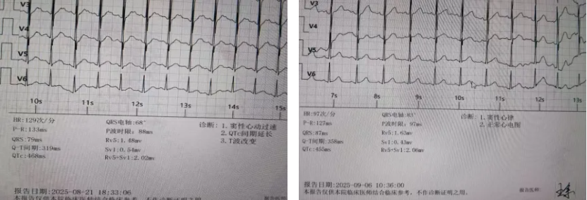 九死一生！桂林医科大学一附院中西医协同诊疗，为脑梗重症患者筑起生命防线