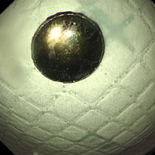 4 岁娃娃咽痛一周,竟藏着 「隐形杀手」!医生提醒:这类物品家家都有