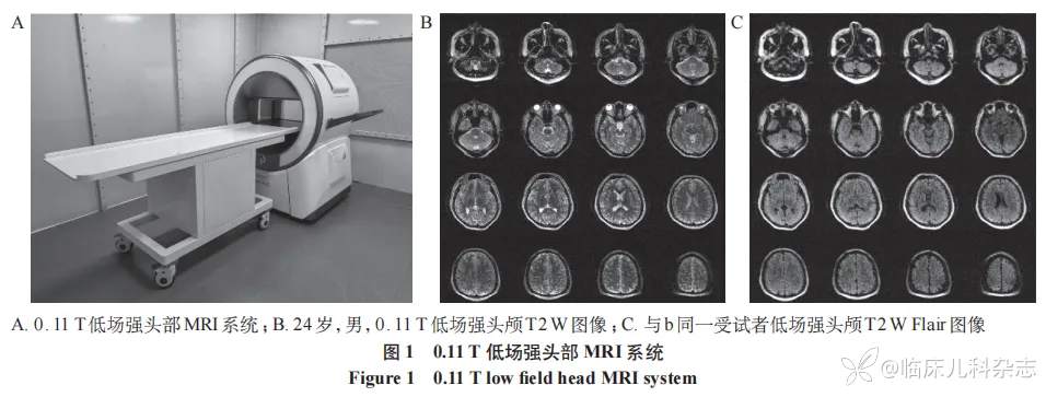 低场强 MRI 在儿科和产前胎儿诊断领域中的应用
