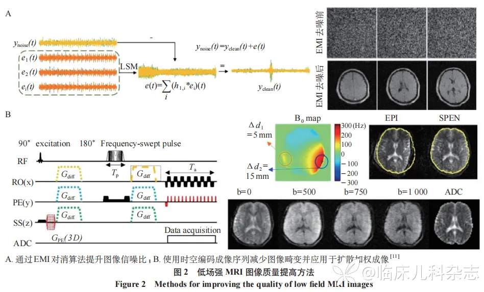 低场强 MRI 在儿科和产前胎儿诊断领域中的应用