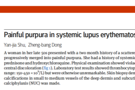 新突破｜中大医院皮肤病临床诊疗成果再登 BMJ