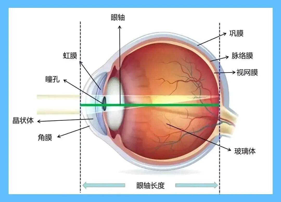 眼轴过长怎么矫正？武汉普瑞眼科林珊解答儿童近视防控有效方式