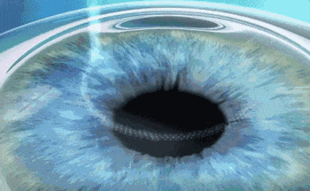 2026 年国考报名启动，视力要求提前看！