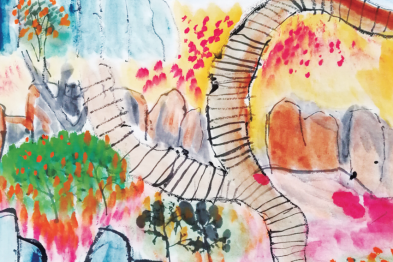 诺西那生钠治疗脊柱侧凸脊髓性肌萎缩症患者的疗效及安全性研究