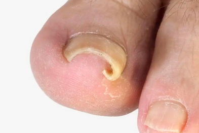 他靠短视频「圈粉」，但留住患者的，是那一手「甲沟炎」绝活