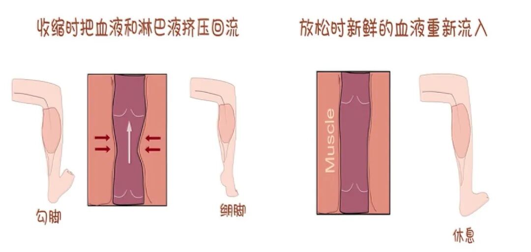 踝泵运动:给腿「泵」走血栓