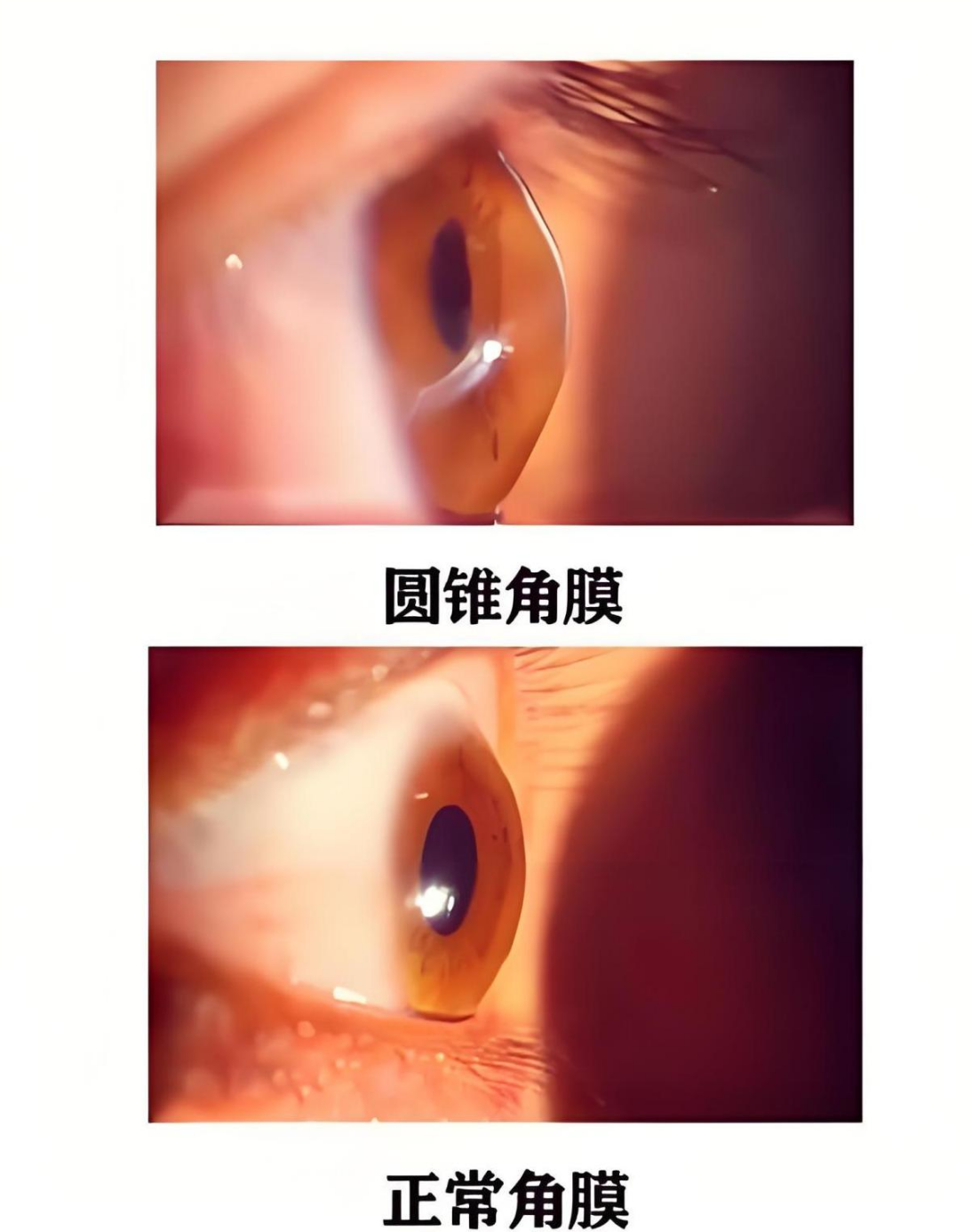 武汉普瑞眼科医院获于第八届普瑞眼科琴台论坛荣获双重认证