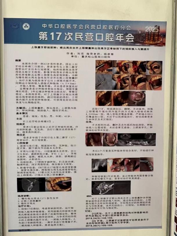 5 篇论文入选全国口腔年会 重庆松山医院口腔科成果获赞