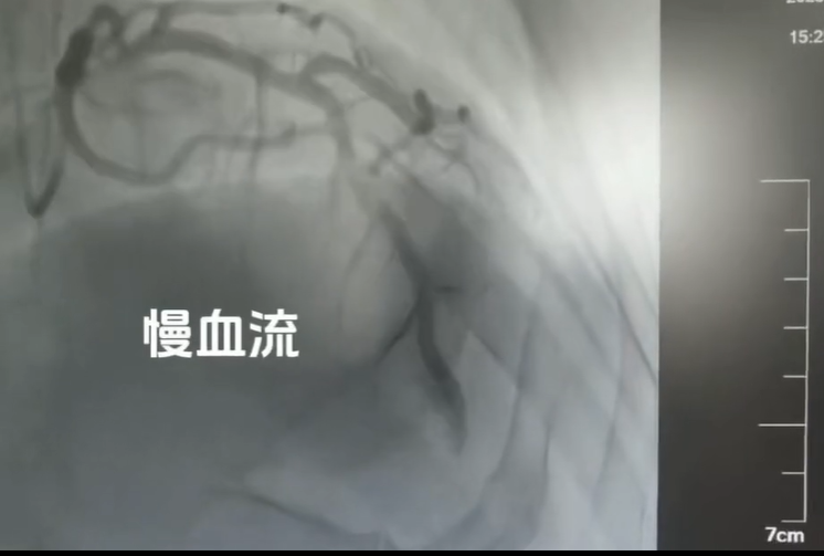 专业护航防治路，守护生命伴同行