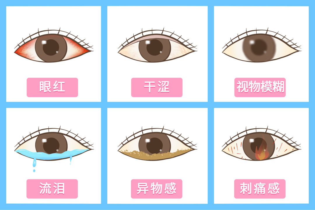 眼睛干涩就是缺水？