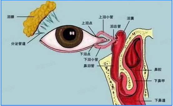 眼睛不自主流泪是什么原因?武汉普瑞眼科李强介绍泪道阻塞治疗方法