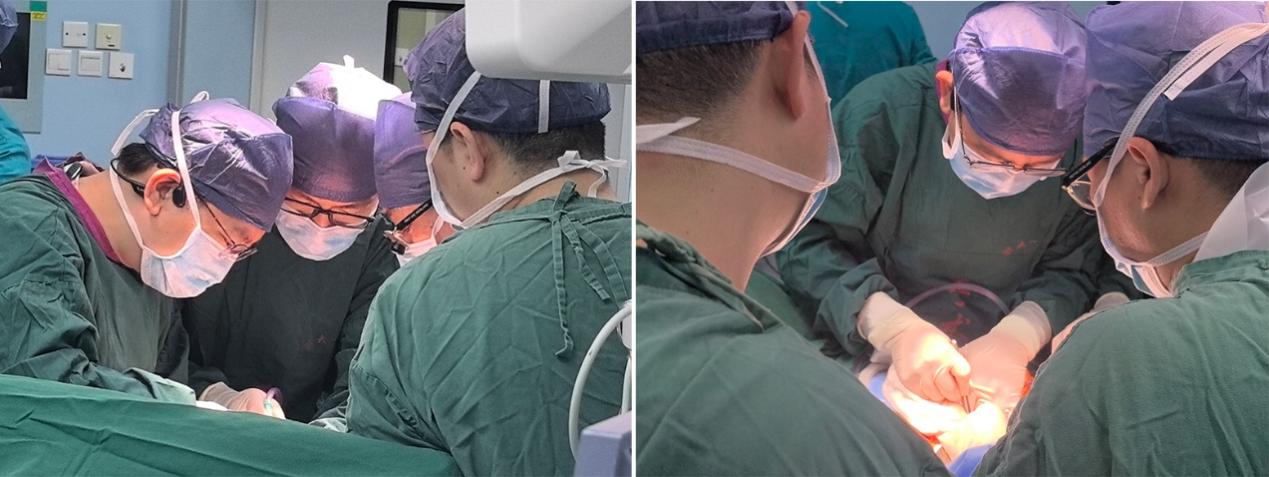 【高难度技术融合】——南昌大学二附院肝胆胰外科团队成功完成一例联合围肝门切除及肝动脉切除重建胆囊癌根治术