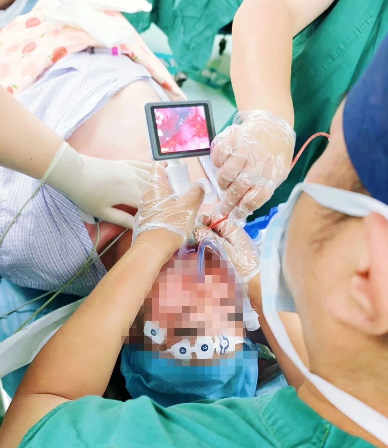 住培「心」声｜从手心冒汗到敬畏生命：一场困难气道麻醉教会我行医的真谛