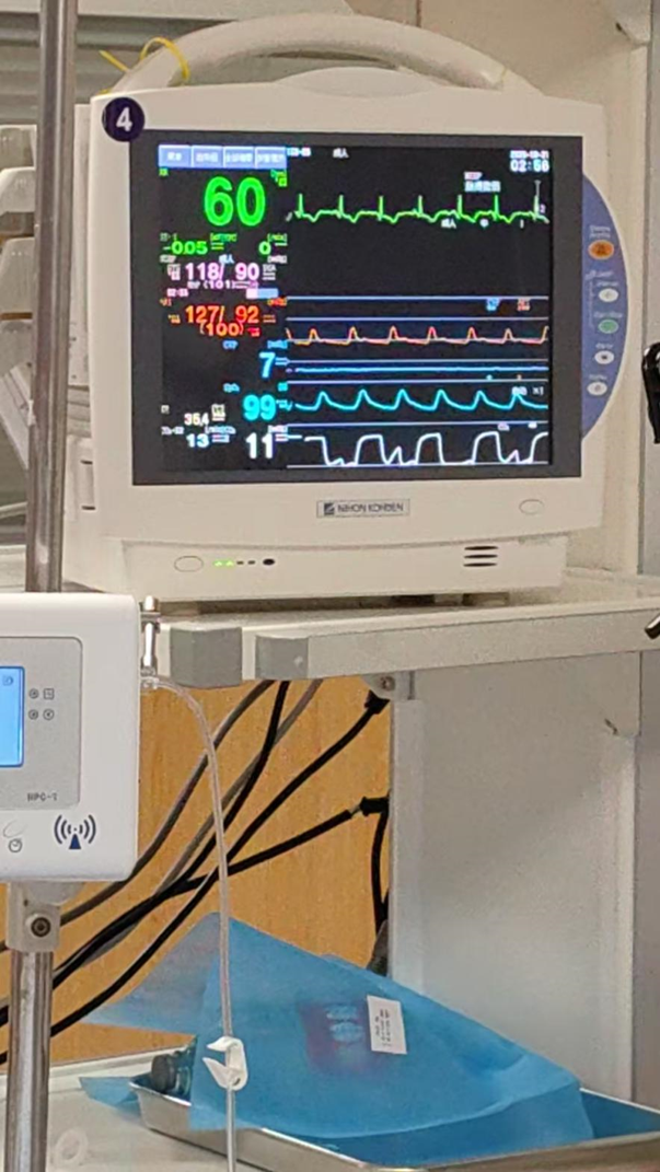 生死时速！ECPR 技术力挽狂澜 ，我院成功打赢首例 「体外生命支持」 攻坚战！