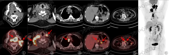 生命雷达精准「护航」抗癌路