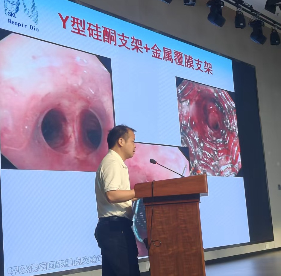 肺癌诊疗与呼吸介入新技术学术大会圆满召开，赋能区域学科发展