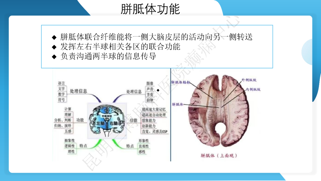 《「痫停」信步》癫痫治疗病例荟萃第三十五期---胼胝体全段切开治疗难治性癫痫 1 例