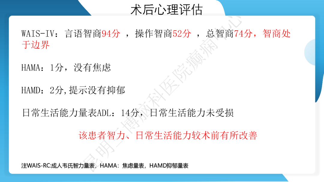《「痫停」信步》癫痫治疗病例荟萃第三十五期---胼胝体全段切开治疗难治性癫痫 1 例