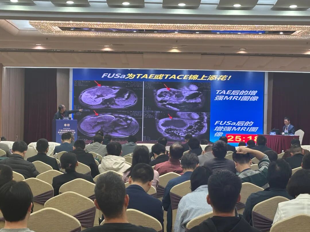 重庆海扶医院首席医学专家陈文直教授系列会议分享恶性肿瘤治疗新策略