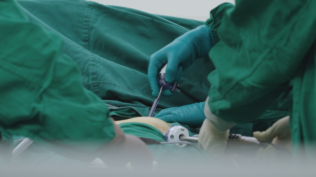 夜间急诊 3 小时 3 mm 戳孔超微创手术,成功抢救异位阑尾急性穿孔患者,生死时速背后是患者的安心托付!