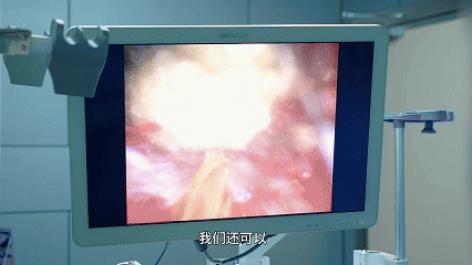 80% 消化早癌没症状?这样查最靠谱