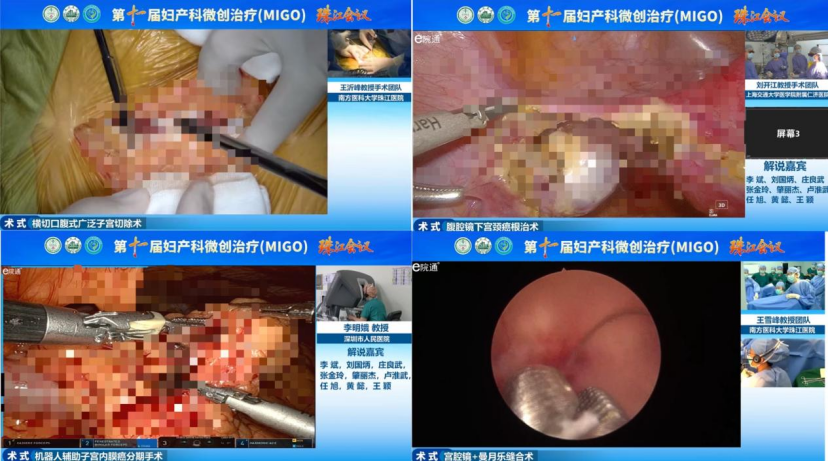 珠江会议进行时 | 聚焦前沿技术赋能临床诊疗!