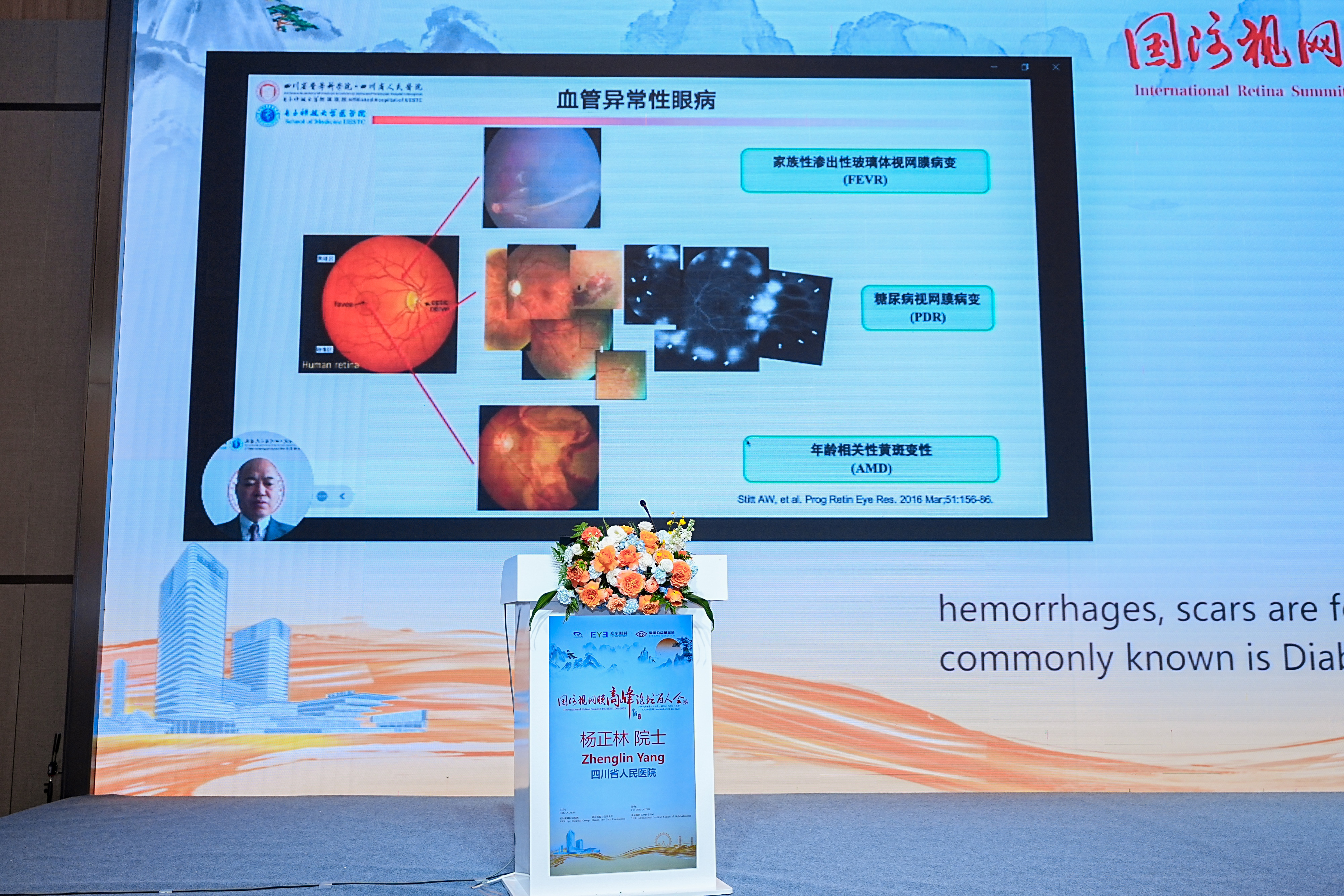 聚焦临床+融合创新——  国际视网膜高峰论坛百人会（IRS100）·2025  为视网膜疾病诊疗提供「全球方案」