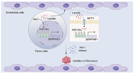 南昌大学二附院王小中教授团队创新成果在国际期刊发表