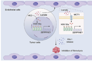 南昌大学二附院王小中教授团队创新成果在国际期刊发表