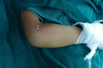 打球时受伤，事后处理不当，造成终身遗憾！@所有家长