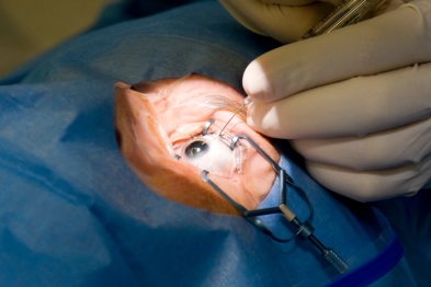 在丁香园看院士教做手术，我连发 5 篇病例