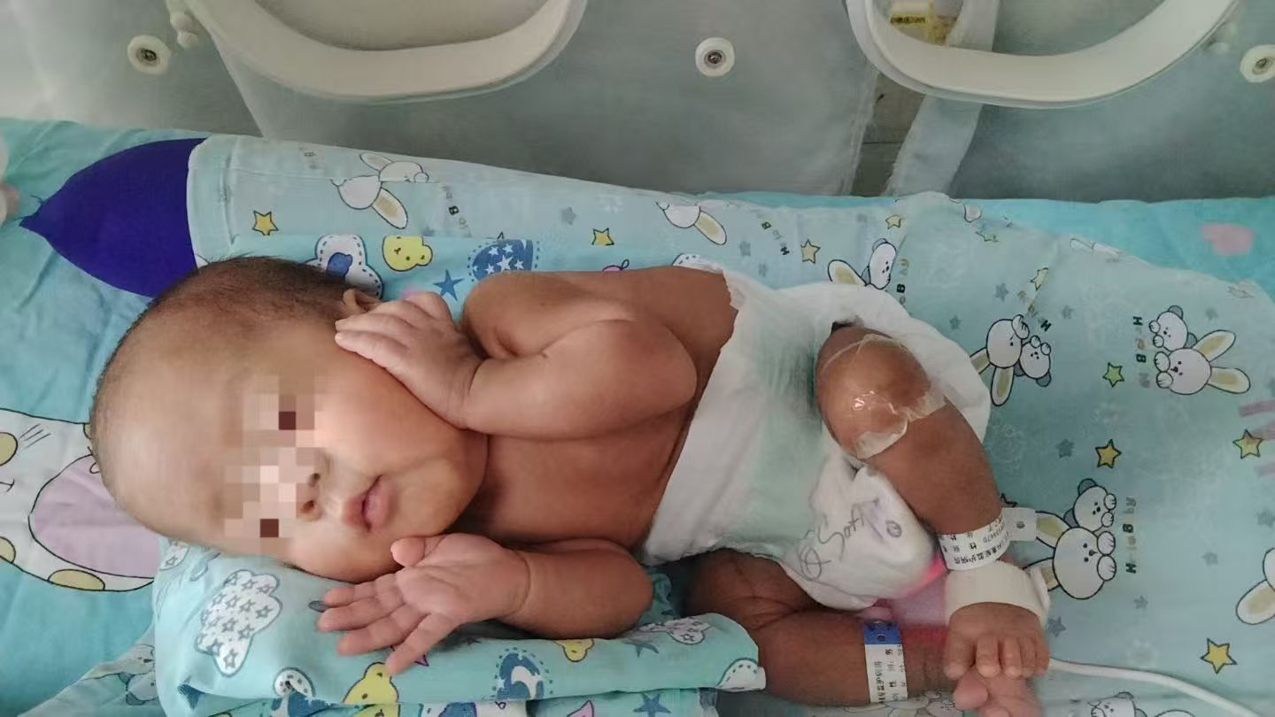 「从未想过放弃!」生死竞速 88 天,西北妇儿成功救下 24 周超早产宝宝