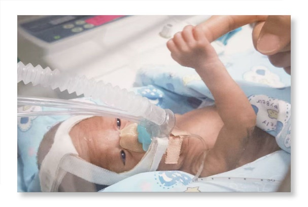 「从未想过放弃!」生死竞速 88 天,西北妇儿成功救下 24 周超早产宝宝