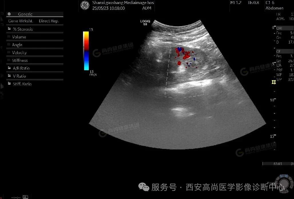 0211668112789824991.jpg?file=751444686