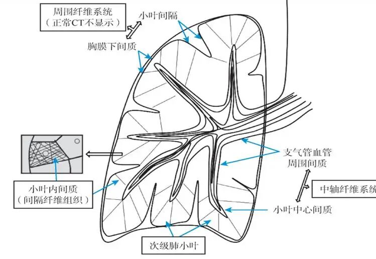 【高尚病例】PET-CT 肺部疑难病例一例分享