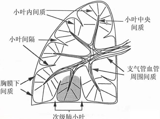 【高尚病例】PET-CT 肺部疑难病例一例分享