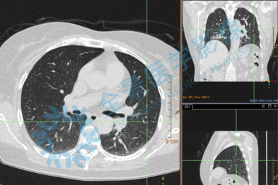 「咳嗽」、「头疼」常见症状背后的原因也许并不简单 以影为索 照见健康