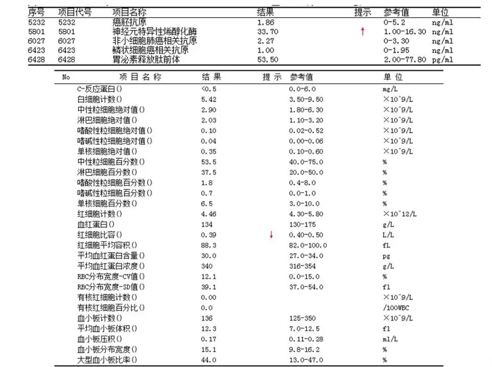 【高尚病例】PET-CT 肺部疑难病例一例分享